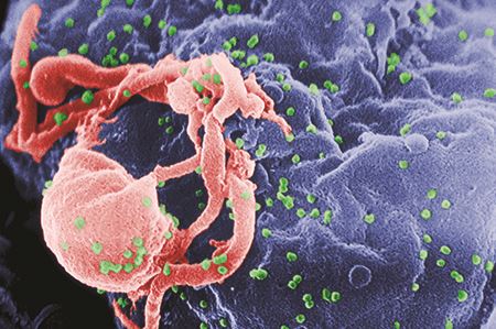 Electron Micrograph of HIV-1 viruses